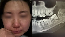 zhanqun.vip,女子疑因被拔错牙坠楼身亡,揭开医疗纠纷背后的悲剧真相